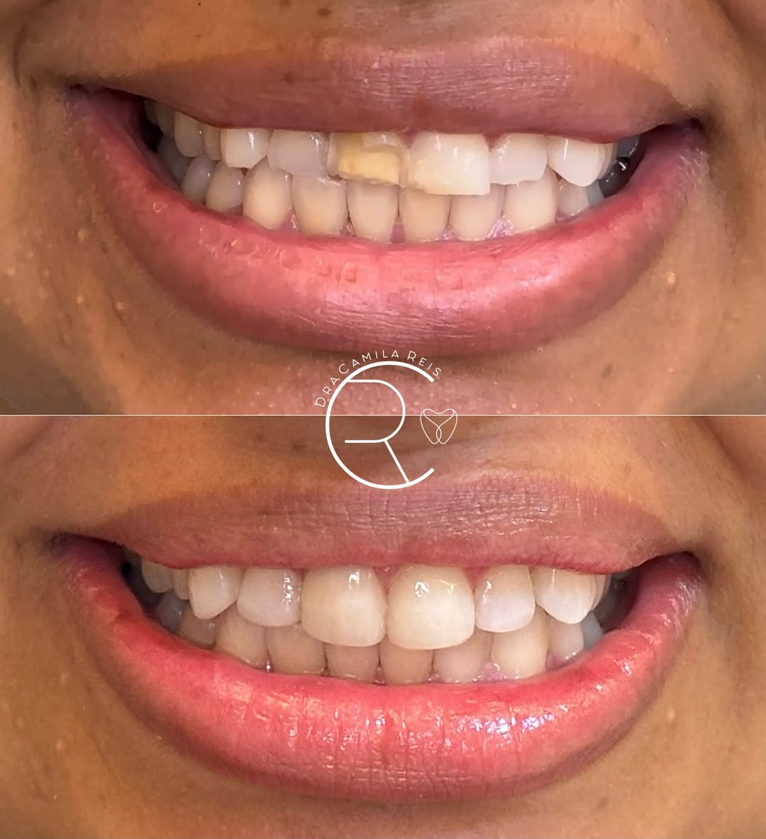 Antes e depois - Dra. Camila Reis