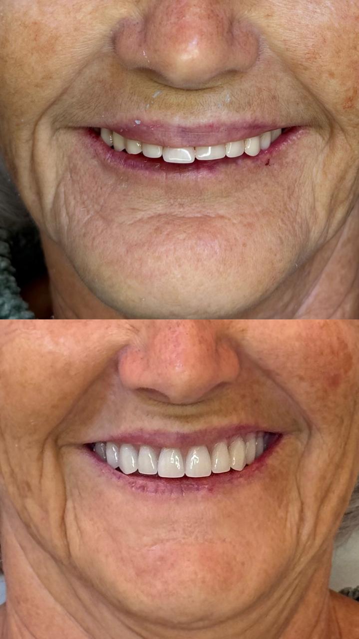 Antes e depois - Dra. Camila Reis